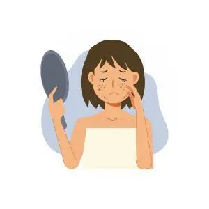Homeopathic solutions for Acne Skin Care